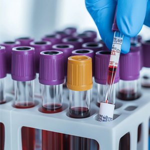 blood-tests-eg-cbc-lipid-panel